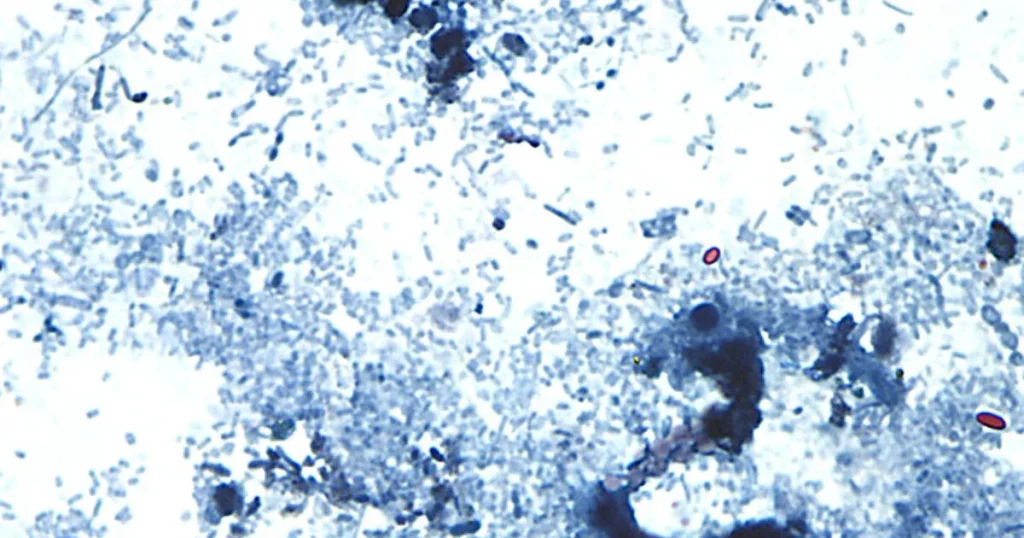 ap26189642009611