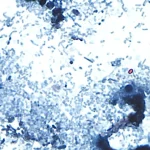 ap26189642009611