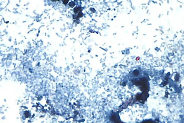 ap26189642009611